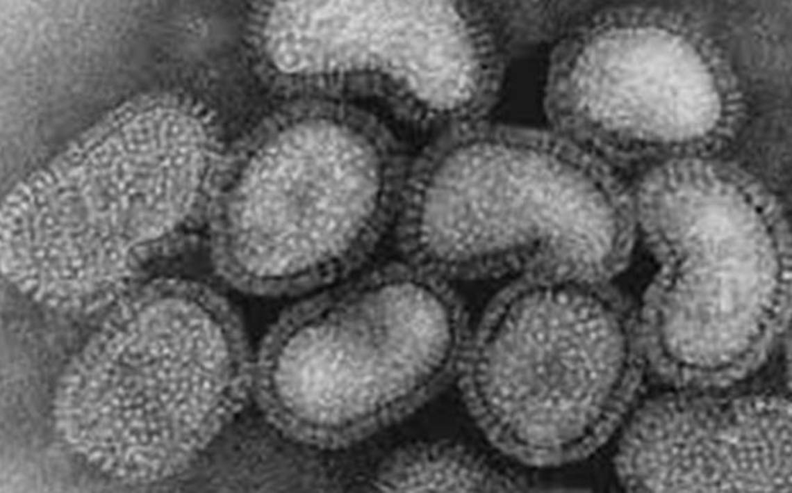 Заболевание грипп б. Вирус гриппа под микроскопом. Вирус гриппа типа а под микроскопом. Вирусы под микроскопом. Вирус гриппа б.
